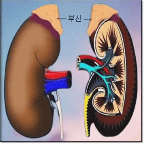 부신 종양으로 인한 쿠싱증후군