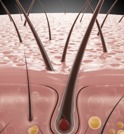탈모란 무엇인가?