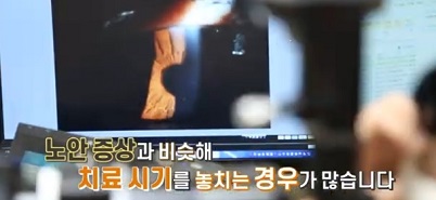 노안증상