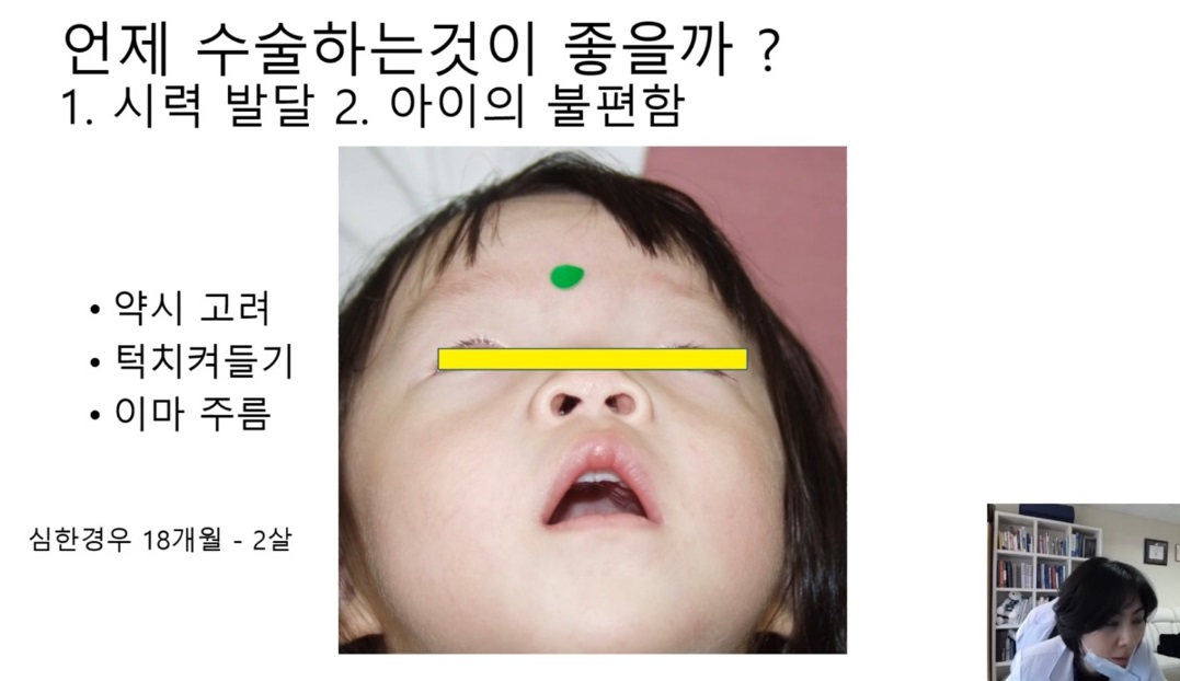 언제수술하는것이좋을까