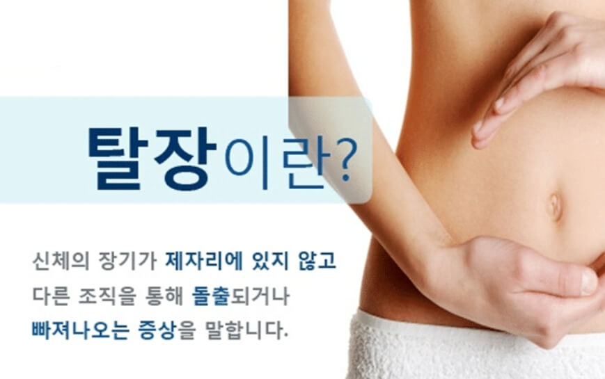 탈장
