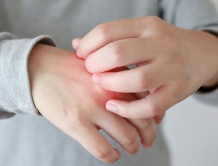 가려워서-손-긁는-사진