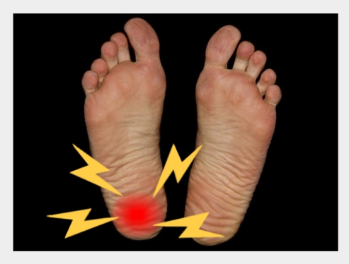 족저근막염 증상