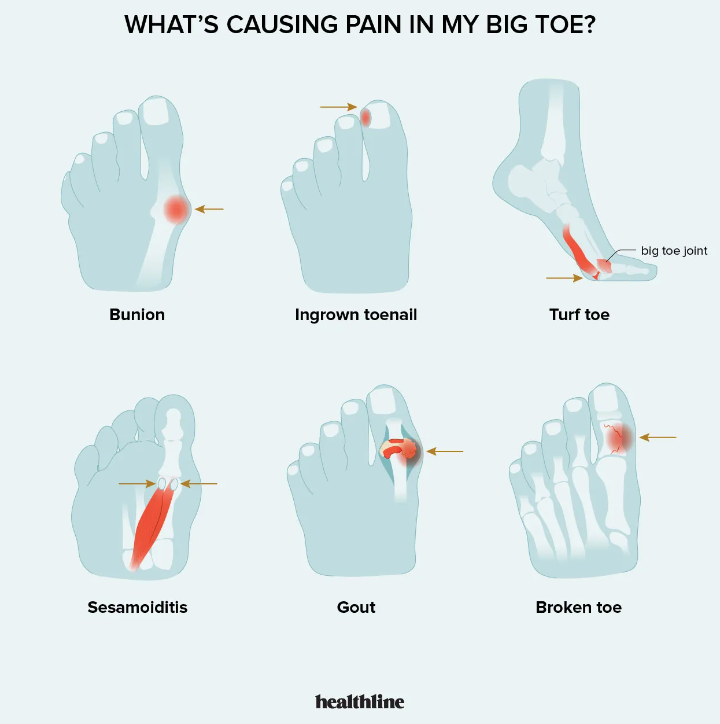 μμ§λ°κ°λ½ ν΅μ¦ μμΈ