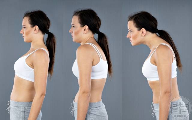 칼슘이 부족하면 나타나는 증상,골다공증 등 허리 굽어