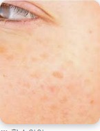 ๊ธฐ๋ฏธ ์์ ๋ ๋ฐฉ๋ฒ