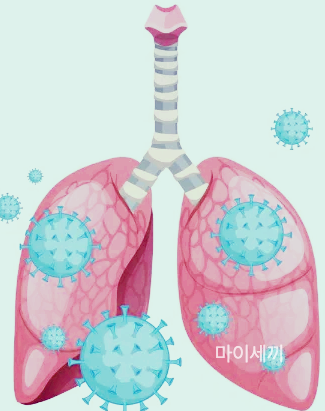 마이코플라즈마