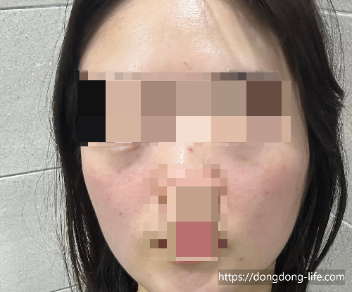 중계의원 기미 리뷰