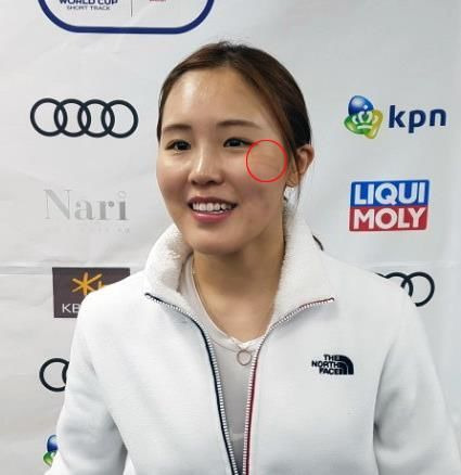 김아랑 SM C&amp;C 전속계약｜프로필&middot;나이&middot;키&middot;결혼&middot;은퇴 이유&middot;해설&middot;시구