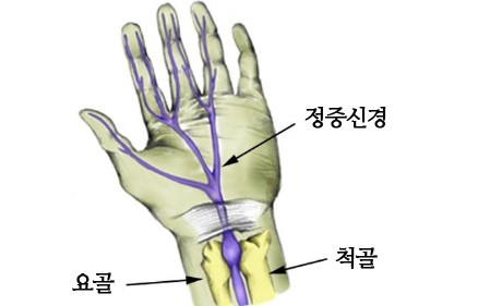 중중신경 이미지