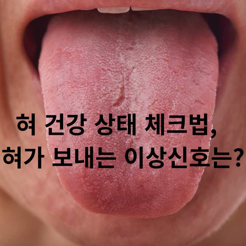 혀 건강 상태 체크법