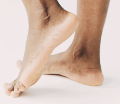 티눈 없애는 방법