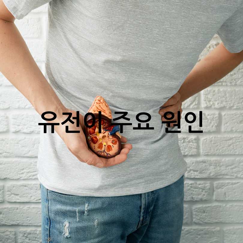 다낭성 신장증후군 증상과 치료법