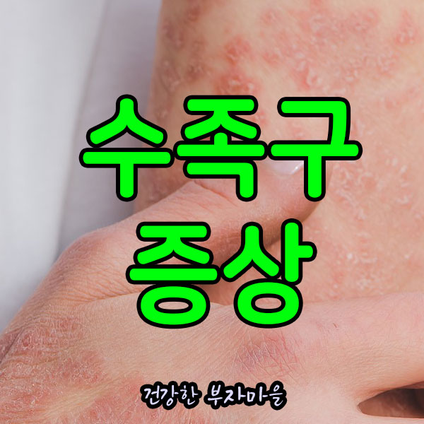 수족구_증상