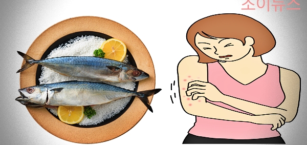 등푸른생선 식품알레르기 증상