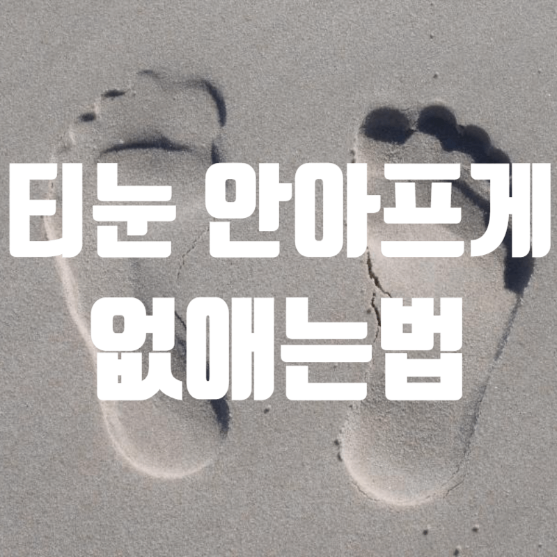 티눈 안아프게 없애는 방법