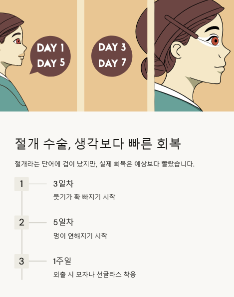 절개 수술 생각보다 빠른 회복