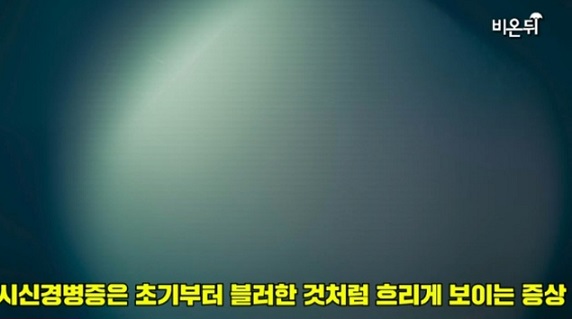 시신경병증