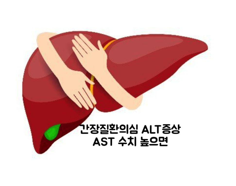 간장질환의심