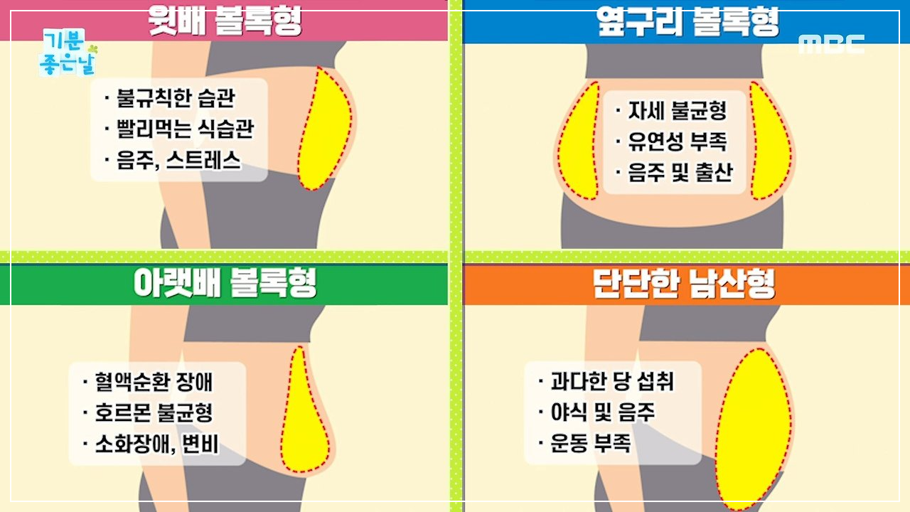 뱃살유형