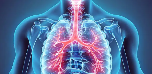 만성 하기도질환 관련 사진