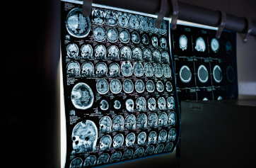 조영제가 구현하는 이미지