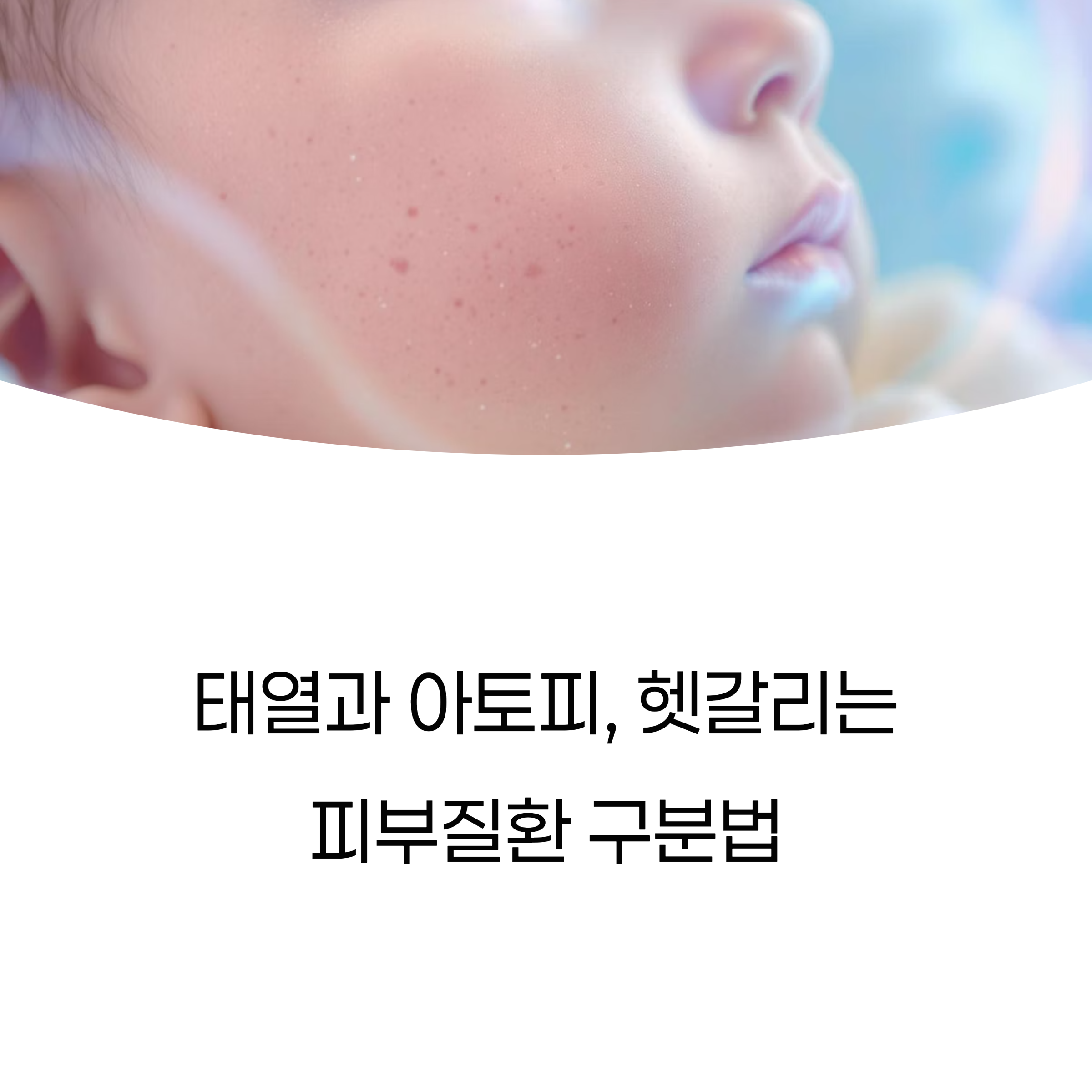 아기 얼굴에 붉은 발진이 보이는 이미지와 &lsquo;태열과 아토피, 헷갈리는 피부질환 구분법&rsquo;이라는 문구가 적힌 인포그래픽