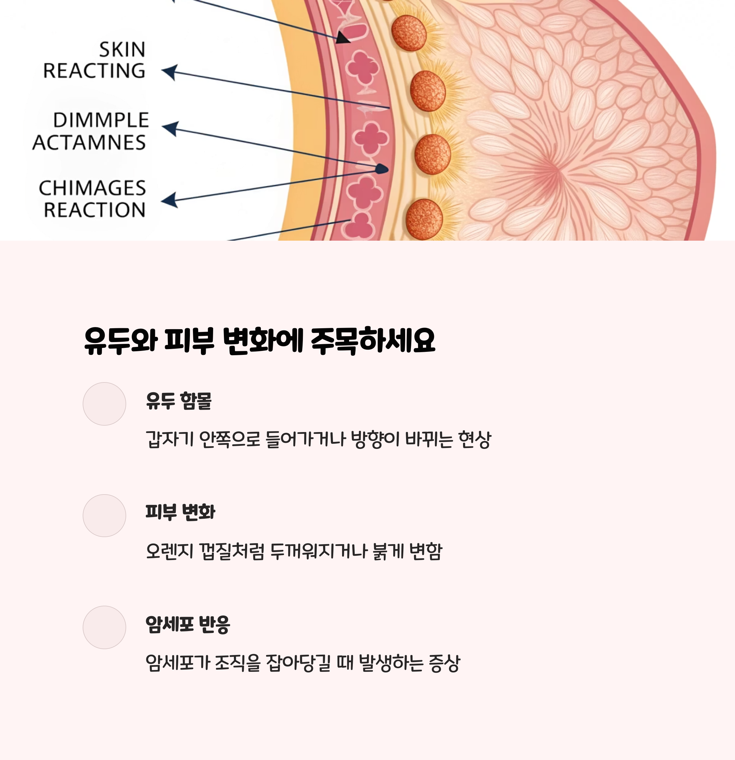 유두와 피부의 갑작스러운 변화