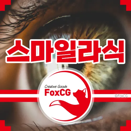 스마일 라식수술 비용/가격 시술시간&#44; 장점과 부작용