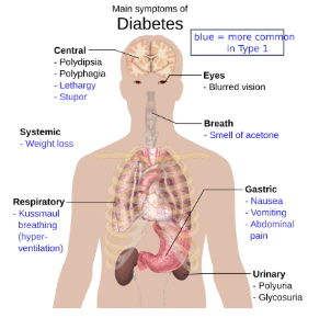 우리의 몸 예시