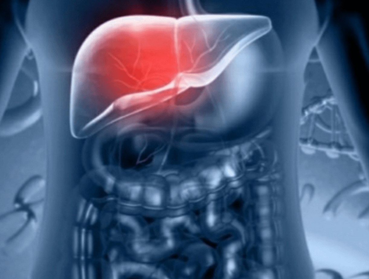 밀크시슬 부작용