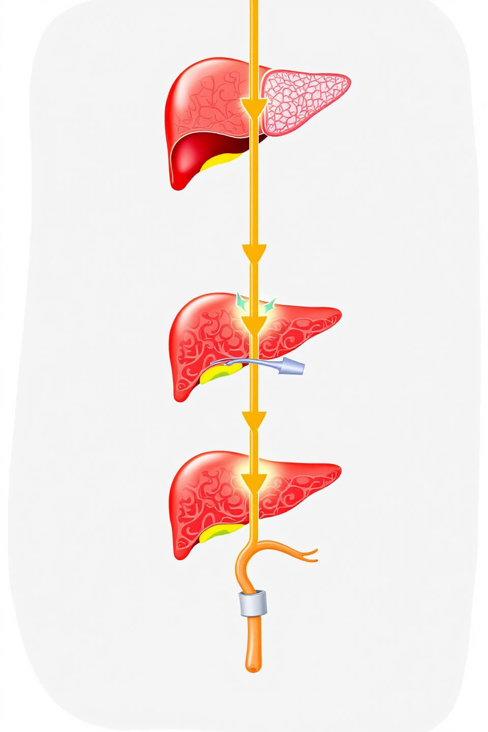 밀크씨슬 사진입니다.