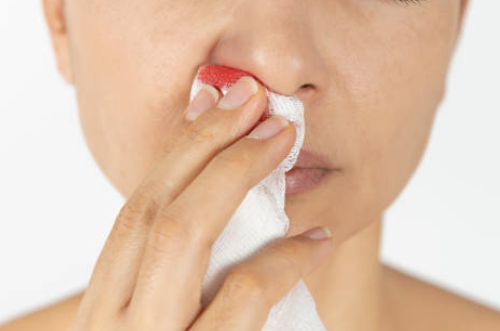 코피가 자주나는 이유 7