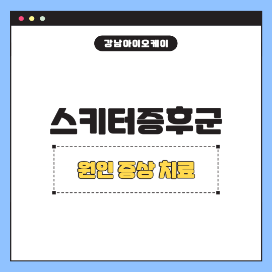 스키터증후군