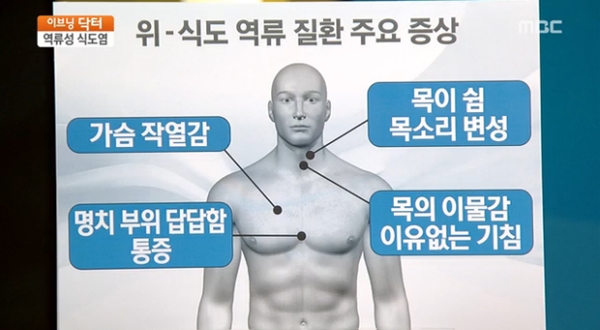 역류성 식도염 음식보다 중요한 생활 습관