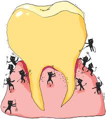 잇몸 염증 치료약 