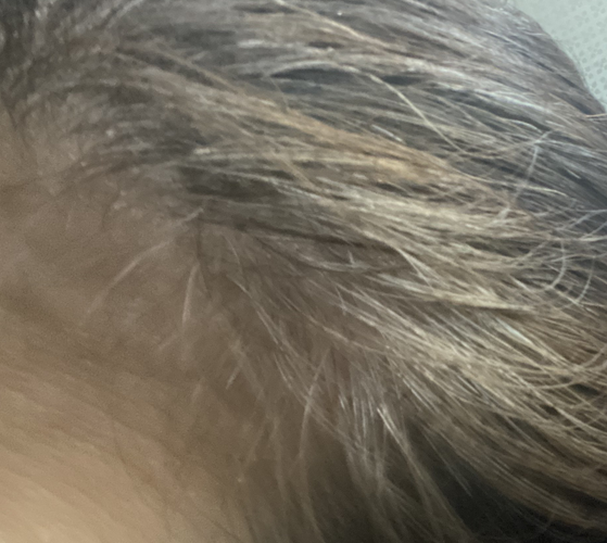 Alt 속성 문제 해결 설명 이미지