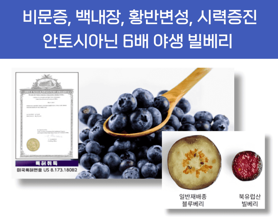 비문증 눈영양제
