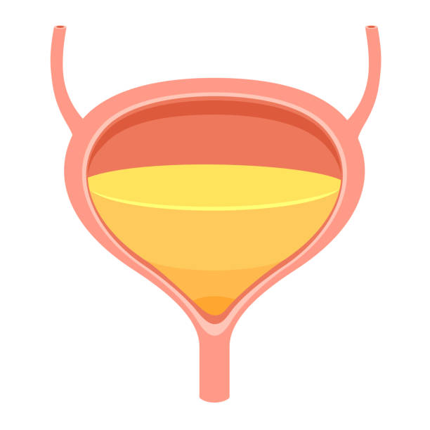잔뇨의 원인과 증상 치료 및 예방법