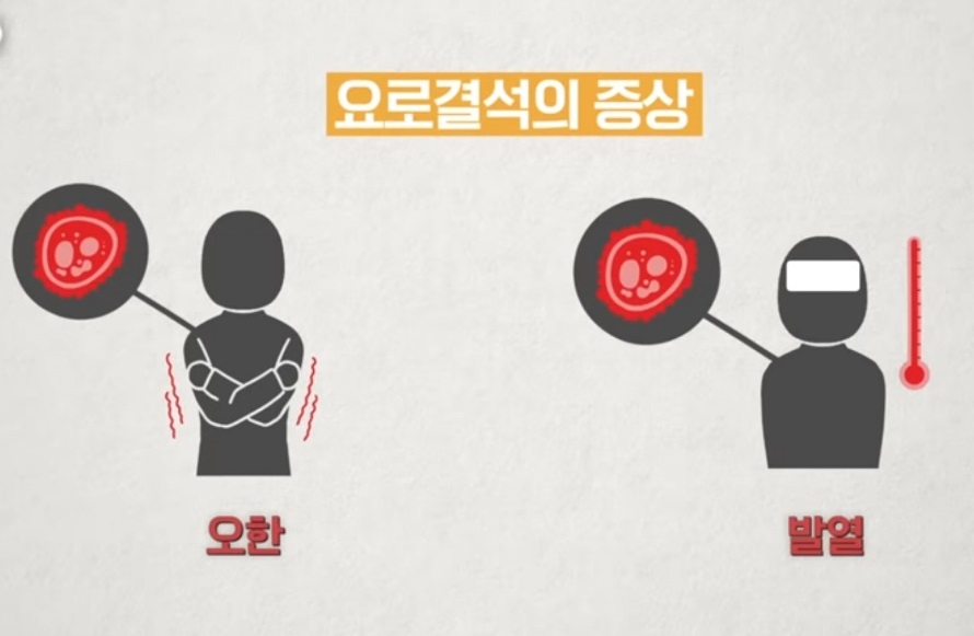 요로결석증상