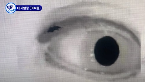 안진검사