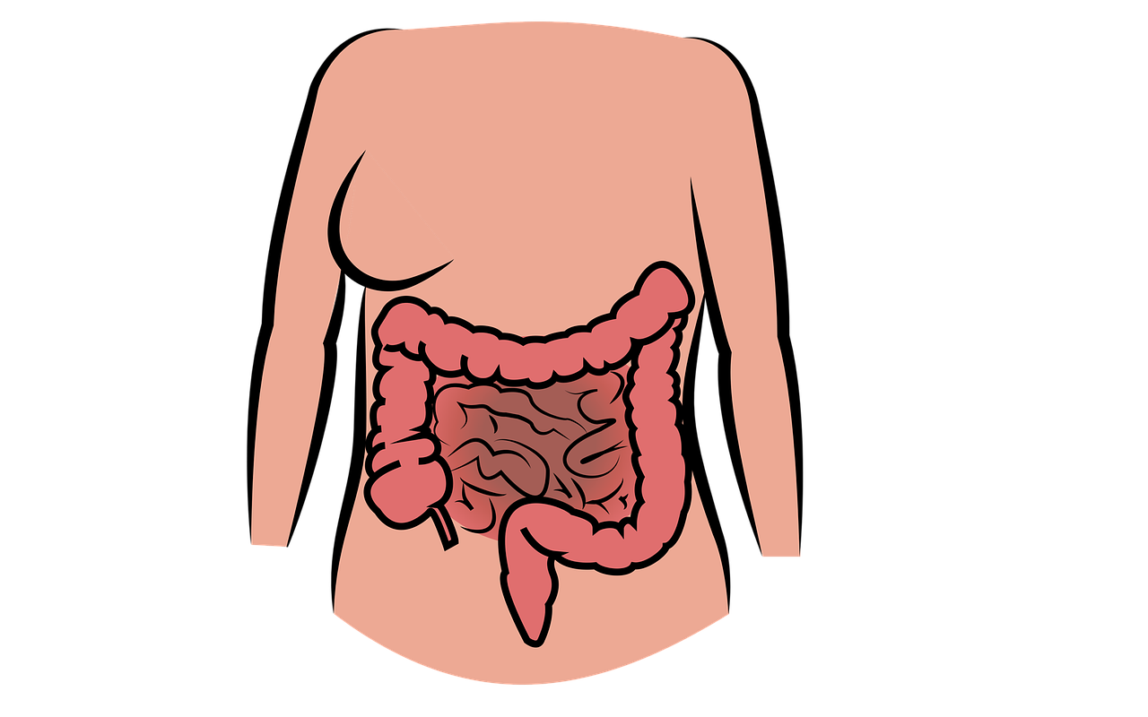 과민성 대장 증후군에 관한 그림