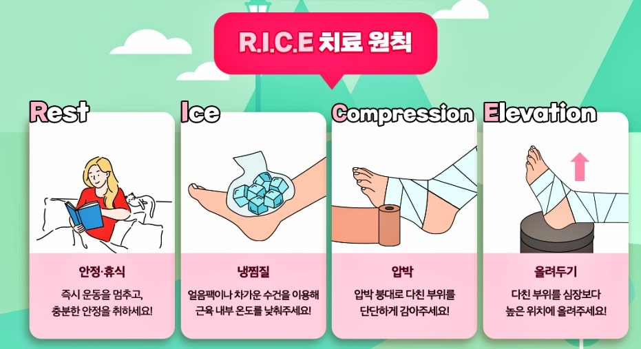 발목-염좌 -치료법: RICE 요법