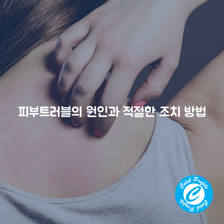피부트러블의 원인과 적절한 조치 방법