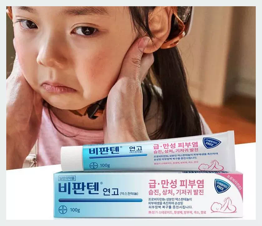 비판텐 연고:일광 화상