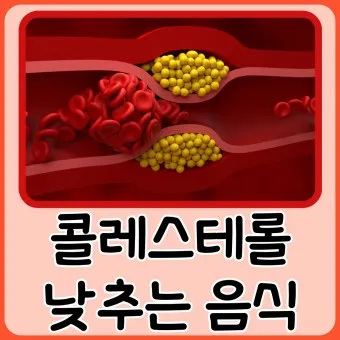 LDL 콜레스테롤 정상수치 낮추는법_4