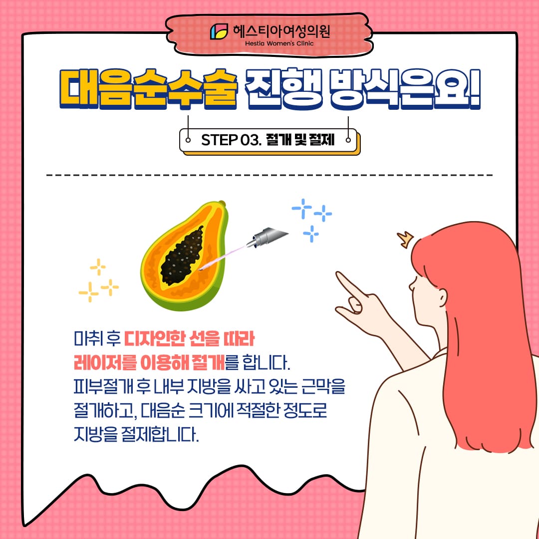 대음순수술 진행방식 Step 3. 절개 및 절제