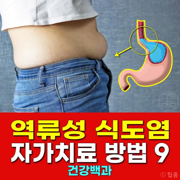 역류성식도염 자가치료