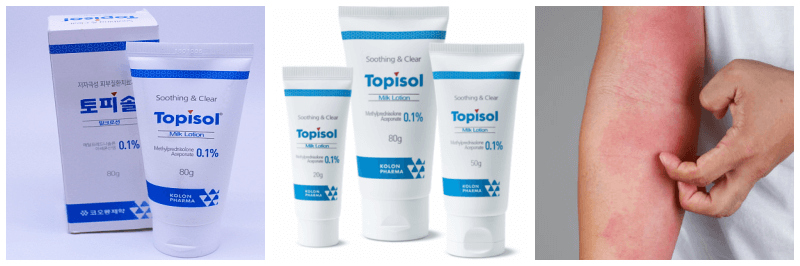 토피솔 밀크로션, 아토피 사진
