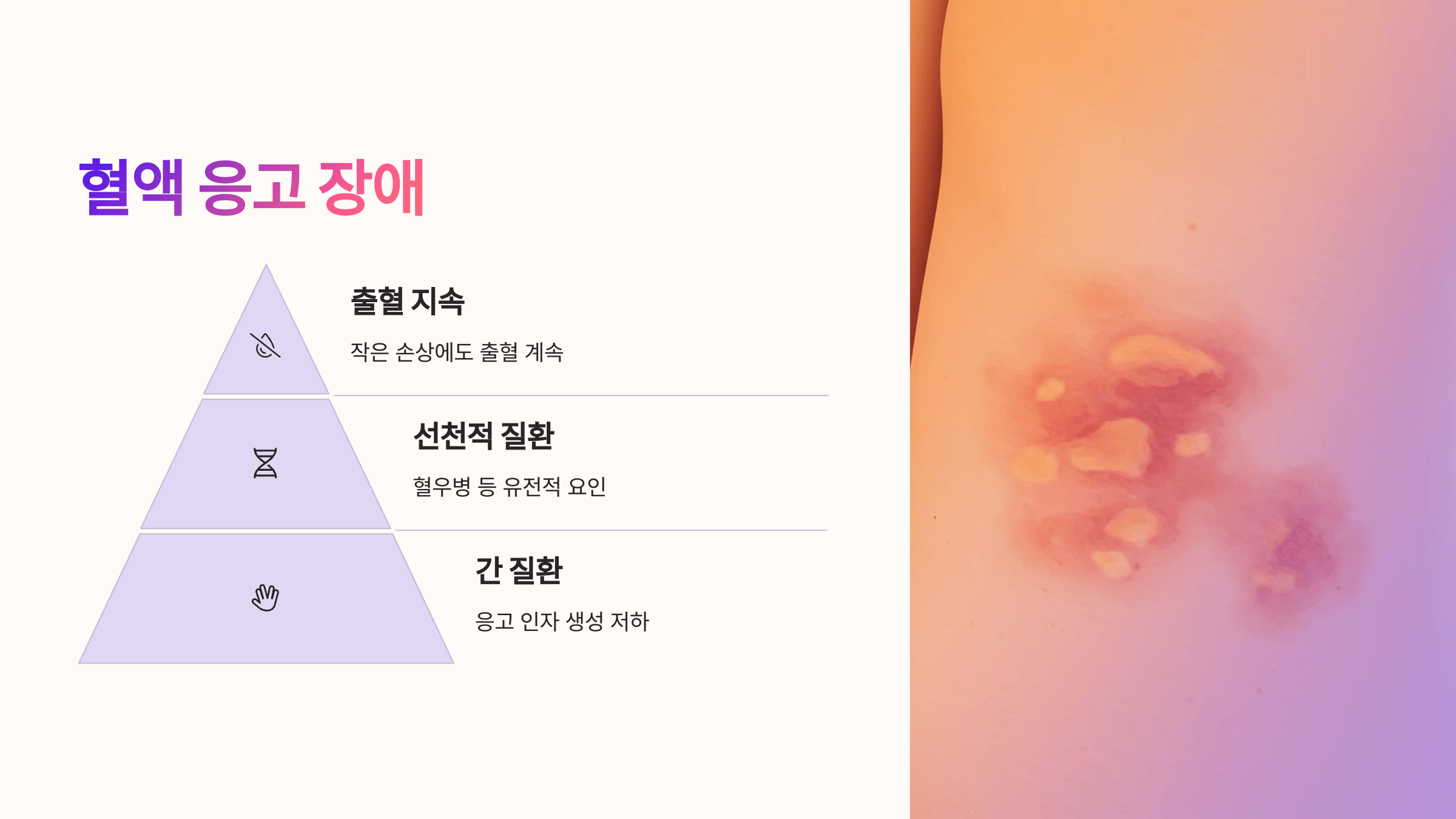 멍과 관련된 사진입니다.